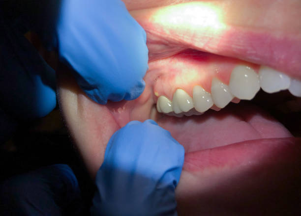 Best Emergency Denture Repair in Bonner Springs, KS